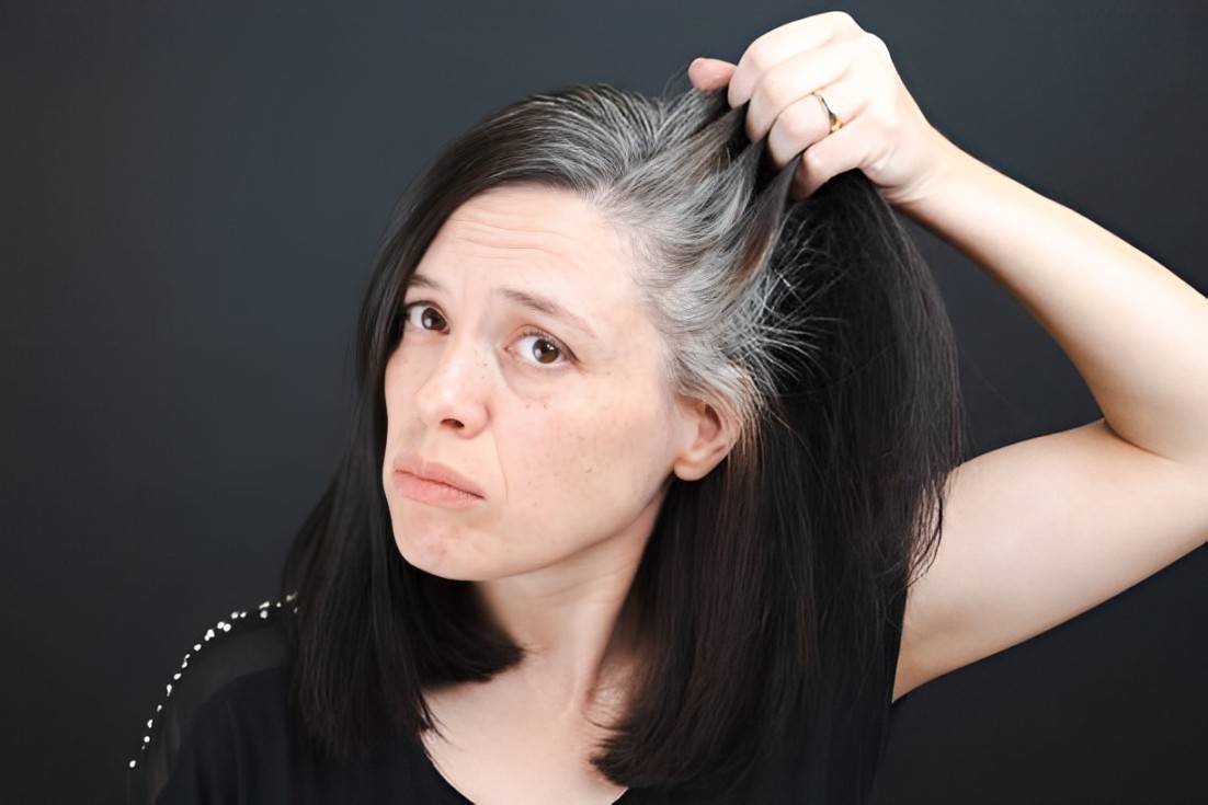 wellhealthorganic.com/know-the-causes-of-white-hair-and-easy-ways-to-prevent-it-naturally